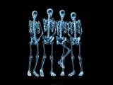 Funny Skeletons Xray
